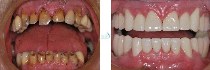 EuroMed Dental Sense1