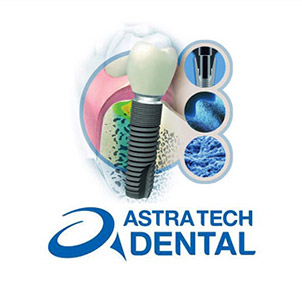 astra tech implantater