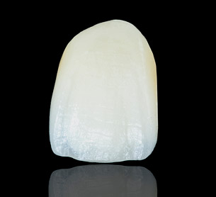 protetikk tannfasetter i porselen
